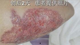 洗纹身男孩视频爆料,背后真相与网络热议