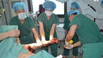 结扎视频手术过程视频,直观了解微创手术步骤